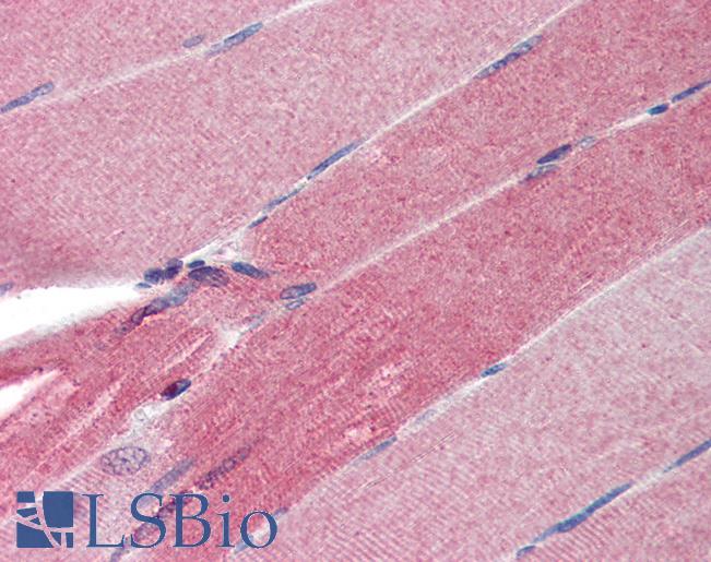 Anti-FHL1 antibody IHC of human skeletal muscle. Immunohistochemistry of formalin-fixed, paraffin-embedded tissue after heat-induced antigen retrieval. Antibody LS-B3484 concentration 5 ug/ml.