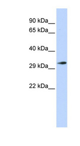 FHL1 antibody LS-B3484 Western blot of Fetal Brain lysate.