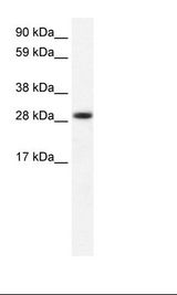 Fetal Muscle Lysate