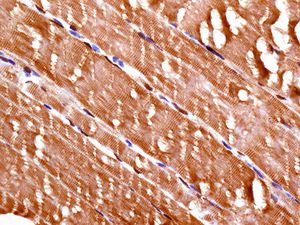IHC of paraffin-embedded human muscle tissue using anti-FHL1 antibody.