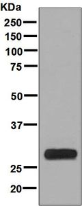 Western blot analysis on fetal muscle lysate using anti-FHL1 antibody.