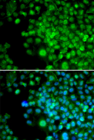 Immunofluorescence blot of HeLa cell using FHL1 antibody. Blue: DAPI for nuclear staining.