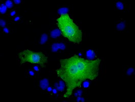 Anti-FHL1 mouse monoclonal antibody immunofluorescent staining of COS7 cells transiently transfected by pCMV6-ENTRY FHL1.