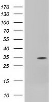 HEK293T cells were transfected with the pCMV6-ENTRY control (Left lane) or pCMV6-ENTRY FHL1 (Right lane) cDNA for 48 hrs and lysed. Equivalent amounts of cell lysates (5 ug per lane) were separated by SDS-PAGE and immunoblotted with anti-FHL1.