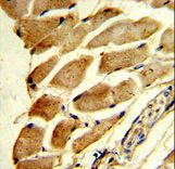 Formalin-fixed and paraffin-embedded human skeletal muscle reacted with FHL1 Antibody , which was peroxidase-conjugated to the secondary antibody, followed by DAB staining. This data demonstrates the use of this antibody for immunohistochemistry; clinical relevance has not been evaluated.