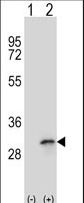 Western blot of FHL1 (arrow) using rabbit polyclonal FHL1 Antibody. 293 cell lysates (2 ug/lane) either nontransfected (Lane 1) or transiently transfected (Lane 2) with the FHL1 gene.