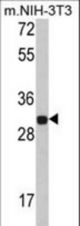 Western blot of FHL1 Antibody in NIH-3T3 cell line lysates (35 ug/lane). FHL1 (arrow) was detected using the purified antibody.