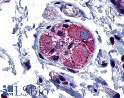 Anti-PTGER4 / EP4 antibody LS-A3890 IHC of human colon, ganglion. Immunohistochemistry of formalin-fixed, paraffin-embedded tissue after heat-induced antigen retrieval.
