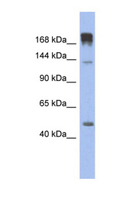 SLIT3 antibody LS-C112251 Western blot of Fetal Muscle lysate.