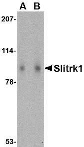 Western blot of Slitrk1 in human brain tissue lysate with Slitrk1 antibody at (A) 1 and (B) 2 ug/ml.