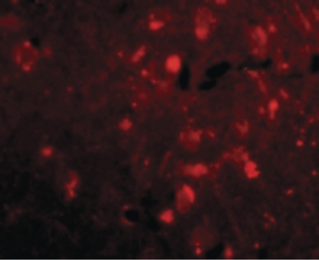 Immunofluorescence of Slitrk2 in Human Brain cells with Slitrk2 antibody at 20 ug/ml.