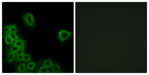 Immunofluorescence of MCF7 cells, using PE2R4 Antibody. The picture on the right is treated with the synthesized peptide.