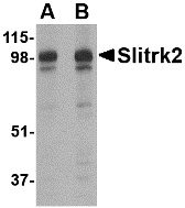 Western blot of Slitrk2 in rat brain tissue lysate with Slitrk2 antibody at (A) 1 and (B) 2 ug/ml.