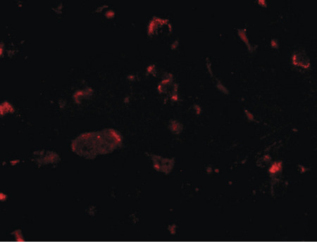 Immunofluorescence of slitrk2 in human brain tissue with slitrk2 antibody at 20 ug/ml.
