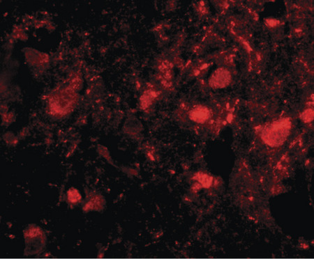 Immunofluorescence of slitrk3 in human brain tissue with slitrk3 antibody at 20 ug/ml.