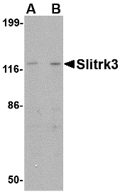 Western blot of Slitrk3 in SK-N-SH cell lysate with Slitrk3 antibody at (A) 0.25 and (B) 0.5 ug/ml.