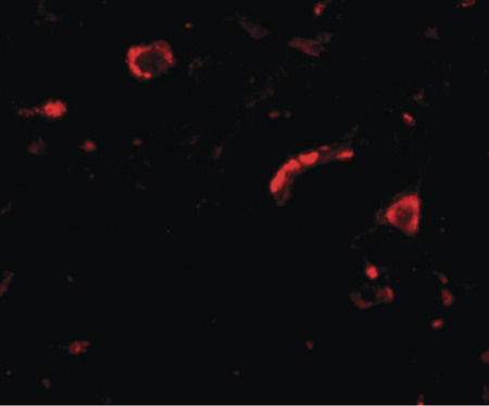 Immunofluorescence of slitrk3 in human brain tissue with slitrk3 antibody at 20 ug/ml.