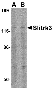 Western blot of Slitrk3 in SK-N-SH cell lysate with Slitrk3 antibody at (A) 0.5 and (B) 1 ug/ml.