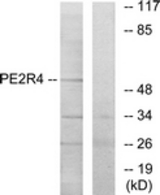 Western blot of extracts from COLO205 cells, using PE2R4 Antibody. The lane on the right is treated with the synthesized peptide.