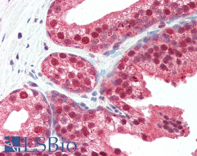 Anti-SLITRK4 antibody IHC of human prostate. Immunohistochemistry of formalin-fixed, paraffin-embedded tissue after heat-induced antigen retrieval. Antibody LS-B3219 concentration 5 ug/ml.