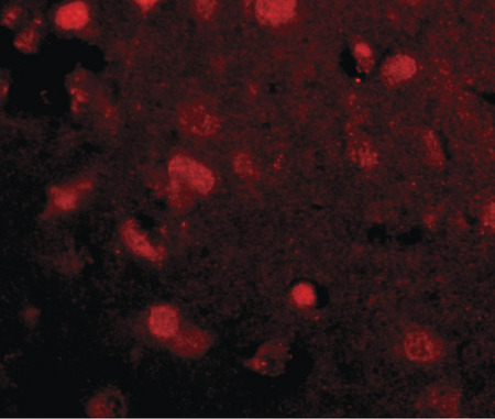 Immunofluorescence of slitrk4 in human brain tissue with slitrk4 antibody at 20 ug/ml.