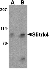 Western blot of Slitrk4 in mouse brain tissue lysate with Slitrk4 antibody at (A) 0.5 and (B) 1 ug/ml.