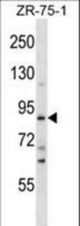 SLITRK4 Antibody western blot of ZR-75-1 cell line lysates (35 ug/lane). The SLITRK4 antibody detected the SLITRK4 protein (arrow).