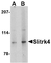 Western blot of Slitrk4 in mouse brain tissue lysate with Slitrk4 antibody at (A) 0.5 and (B) 1 ug/ml.
