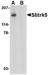 Western blot of Slitrk5 in 3T3 cell lysate with Slitrk5 antibody at 1 ug/ml in the (A) absence or (B) presence of blocking peptide.