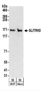 Detection of Human SLITRK5 by Western Blot. Samples: Whole cell lysate (50 ug) from 293T and HeLa cells. Antibodies: Affinity purified rabbit anti-SLITRK5 antibody used for WB at 0.4 ug/ml. Detection: Chemiluminescence with an exposure time of 3 minutes.