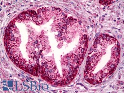 Anti-PTGER4 / EP4 antibody IHC of human prostate. Immunohistochemistry of formalin-fixed, paraffin-embedded tissue after heat-induced antigen retrieval. Antibody LS-B6947 concentration 5 ug/ml.