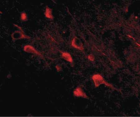 Immunofluorescence of slitrk5 in human brain tissue with slitrk5 antibody at 20 ug/ml.