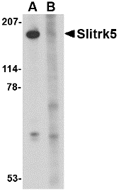 Western blot of Slitrk5 in 3T3 cell lysate with Slitrk5 antibody at 1 ug/ml in the (A) absence or (B) presence of blocking peptide.