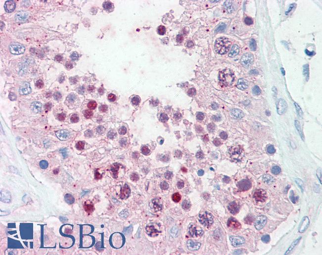 Anti-SLITRK6 antibody LS-A9250 IHC of human testis. Immunohistochemistry of formalin-fixed, paraffin-embedded tissue after heat-induced antigen retrieval.
