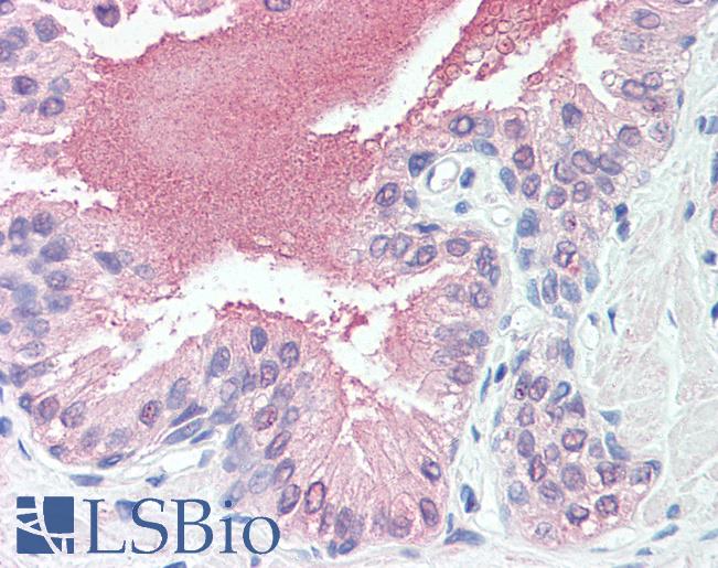 Anti-SLITRK6 antibody LS-A9250 IHC of human prostate. Immunohistochemistry of formalin-fixed, paraffin-embedded tissue after heat-induced antigen retrieval.