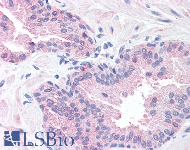 Anti-SLITRK6 antibody LS-A9245 IHC of human prostate. Immunohistochemistry of formalin-fixed, paraffin-embedded tissue after heat-induced antigen retrieval.