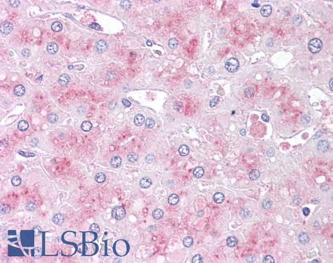 Anti-SLITRK6 antibody LS-A9245 IHC of human liver. Immunohistochemistry of formalin-fixed, paraffin-embedded tissue after heat-induced antigen retrieval.