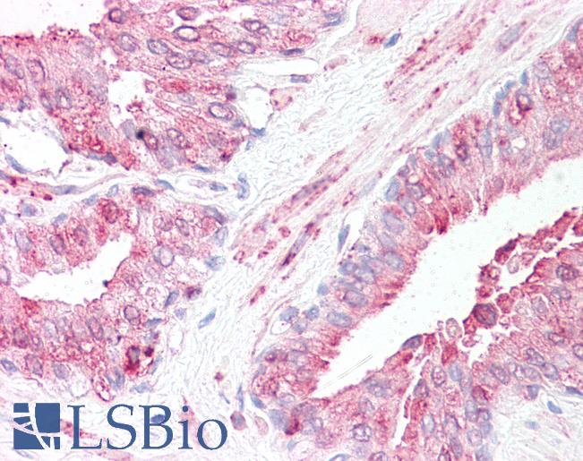 Anti-SLITRK6 antibody LS-A9247 IHC of human prostate. Immunohistochemistry of formalin-fixed, paraffin-embedded tissue after heat-induced antigen retrieval.