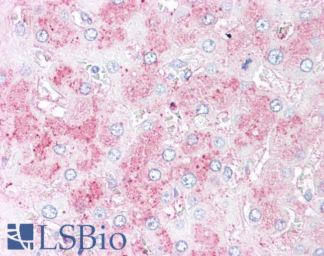 Anti-SLITRK6 antibody LS-A9247 IHC of human liver. Immunohistochemistry of formalin-fixed, paraffin-embedded tissue after heat-induced antigen retrieval.