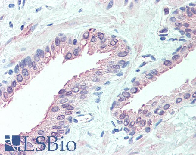 Anti-SLITRK6 antibody LS-A9246 IHC of human prostate. Immunohistochemistry of formalin-fixed, paraffin-embedded tissue after heat-induced antigen retrieval.