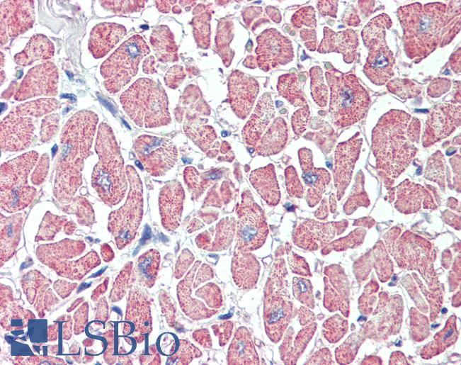 Anti-SLITRK6 antibody LS-A9246 IHC of human heart. Immunohistochemistry of formalin-fixed, paraffin-embedded tissue after heat-induced antigen retrieval.