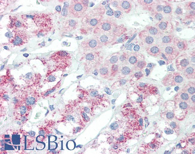 Anti-SLITRK6 antibody IHC of human adrenal. Immunohistochemistry of formalin-fixed, paraffin-embedded tissue after heat-induced antigen retrieval. Antibody LS-B3220 concentration 10 ug/ml.