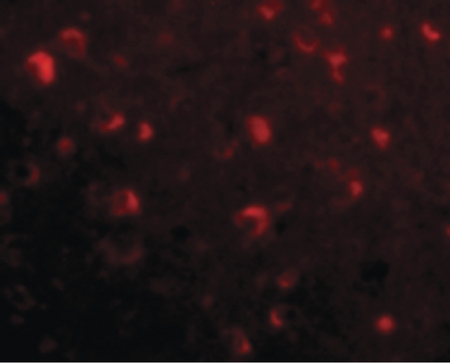 Immunofluorescence of Slitrk6 in Human Brain cells with Slitrk6 antibody at 20 ug/ml.