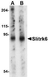 Western blot of Slitrk6 in mouse lung tissue lysate with Slitrk6 antibody at (A) 0.5 and (B) 1 ug/ml.