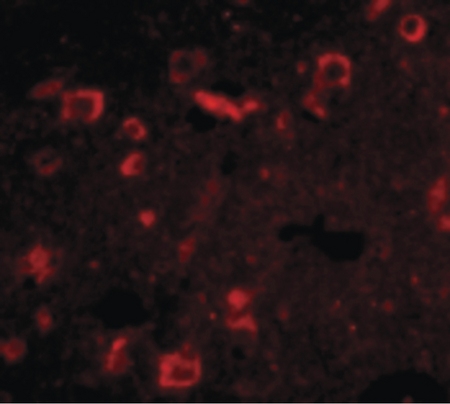 Immunofluorescence of Slitrk6 in Human Brain cells with Slitrk6 antibody at 20 ug/ml.