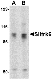 Western blot of Slitrk6 in SK-N-SH cell lysate with Slitrk6 antibody at (A) 0.5 and (B) 1 ug/ml.