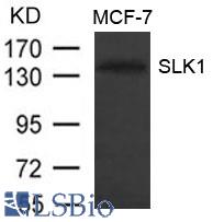 Western blot of extract from MCF-7 cells using SLK1 antibody