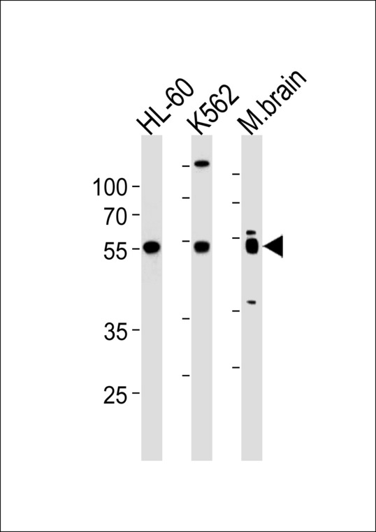 PTGER4 Antibody western blot of HL-60,K562 cell line and mouse brain lysates (35 ug/lane). The PTGER4 antibody detected the PTGER4 protein (arrow).