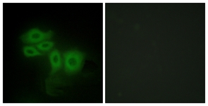 Immunofluorescence of HepG2 cells, using SLK Antibody. The picture on the right is treated with the synthesized peptide.