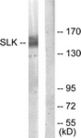 Western blot of extracts from COLO205 cells, using SLK Antibody. The lane on the right is treated with the synthesized peptide.